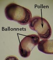 Ballonnet