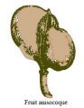 anisocoque