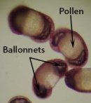 ballonnet