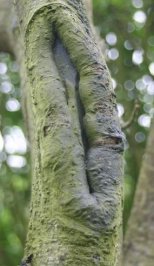 Bourrelet cicatriciel