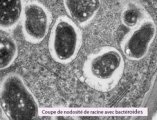 bacteroide